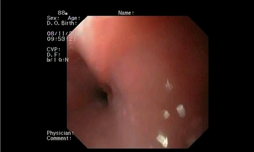 ENDO3&reg;GASTRO - Lite截图3