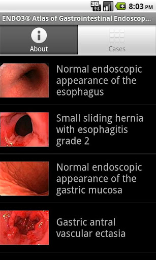 ENDO3&reg;GASTRO - Lite截图2