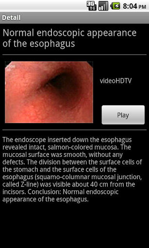 ENDO3&reg;GASTRO - Lite截图4