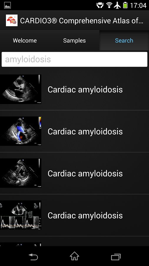 CARDIO3&reg; ECHO - Lite截图6