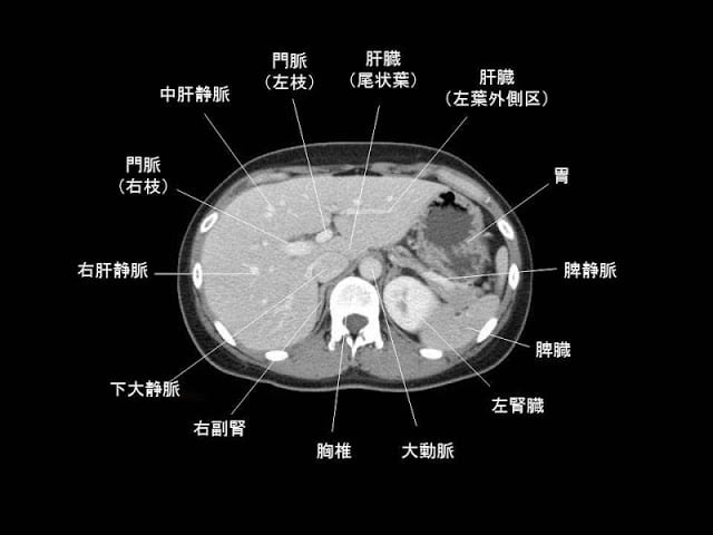 e画像解剖截图6