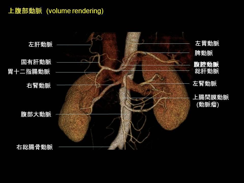 e画像解剖截图3