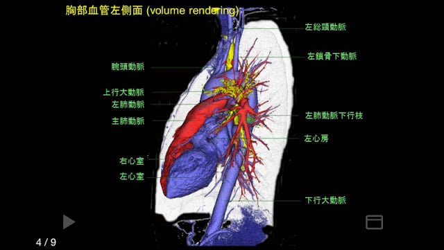 e画像解剖截图5