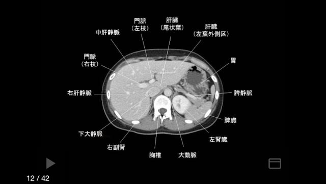 e画像解剖截图8