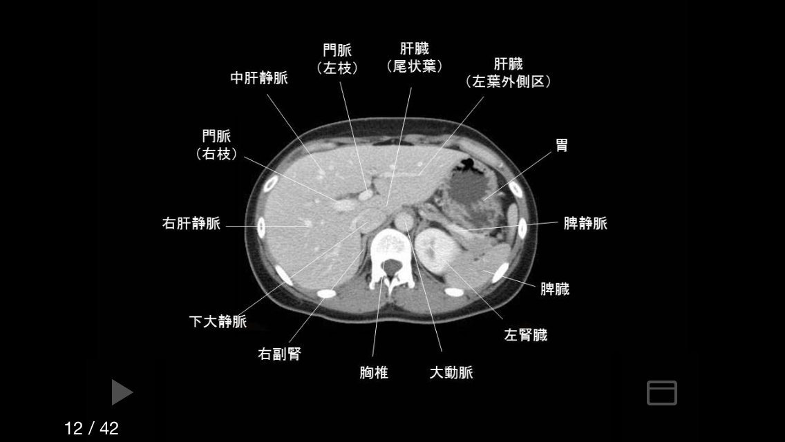 e画像解剖截图2