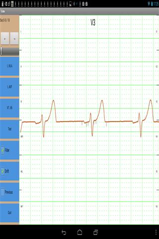 移动心电记录截图2