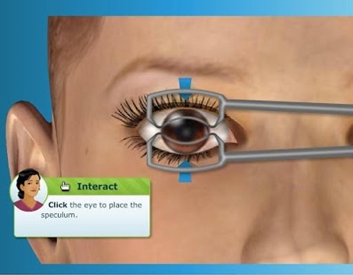 Virtual LASIK Eye Surgery截图8