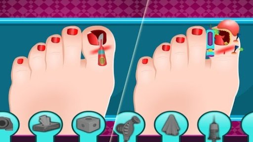 Broken Nail Doctor Care截图4