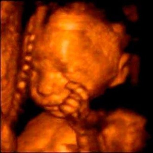 4d Ultrasound, 3d and 2d截图5