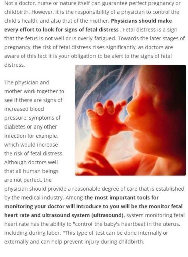 4d Ultrasound, 3d and 2d截图3