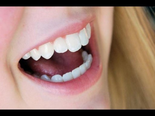 How to Get White Teeth截图4