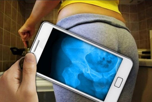 X-Ray Hip Bone截图2