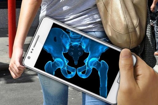 X-Ray Hip Bone截图1