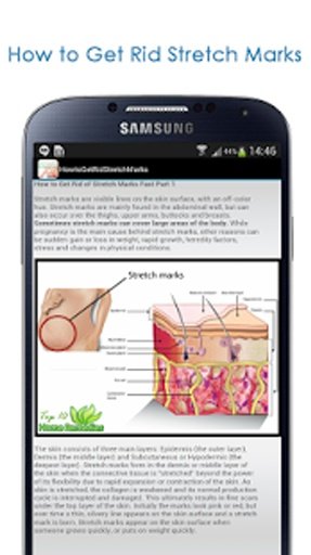 How to Get Rid Stretch Marks截图2