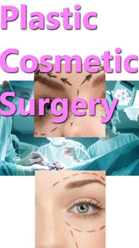 Plastic Cosmetic Surgery截图1