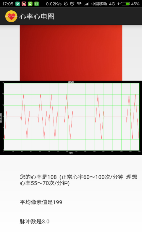 心率心电图截图2