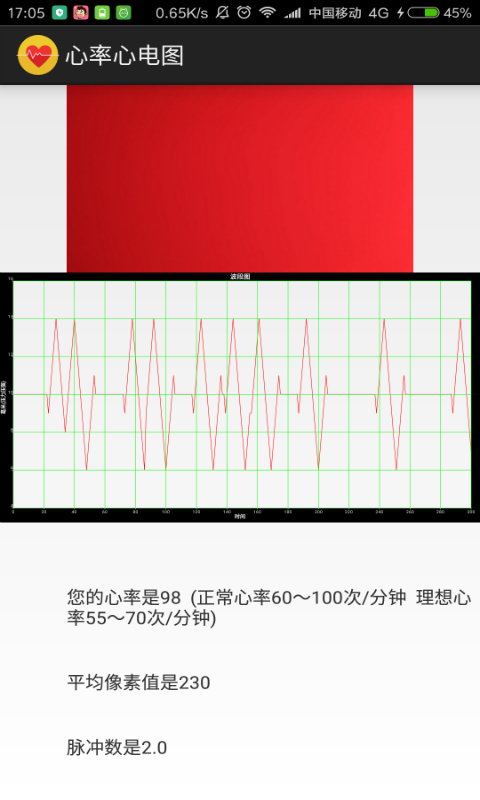 心率心电图截图4