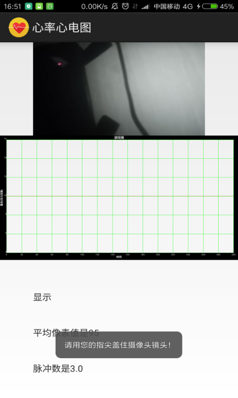 心率心电图截图1