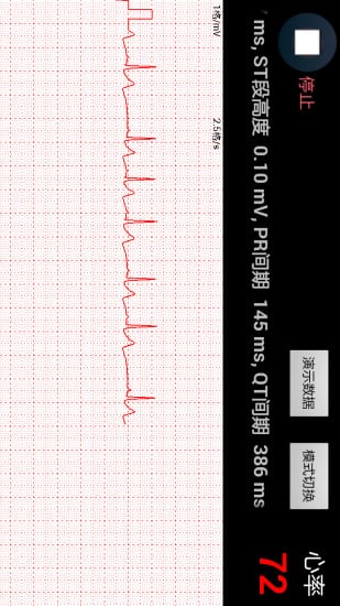 手持心电监护仪截图3