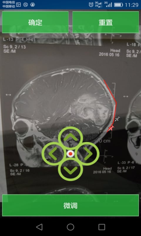 神经外科定位助手截图1