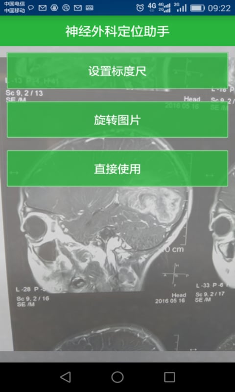 神经外科定位助手截图5