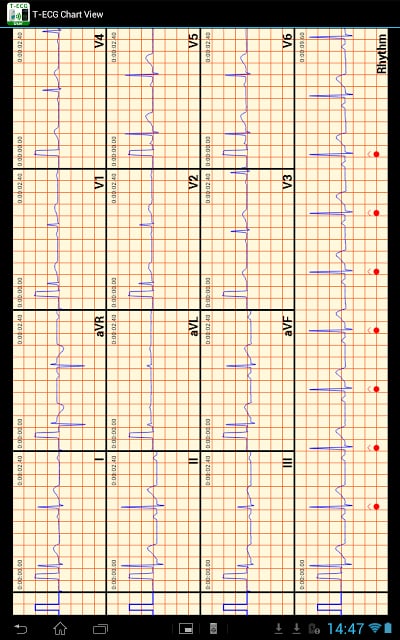 T-ECG User Telephonic ECG截图3