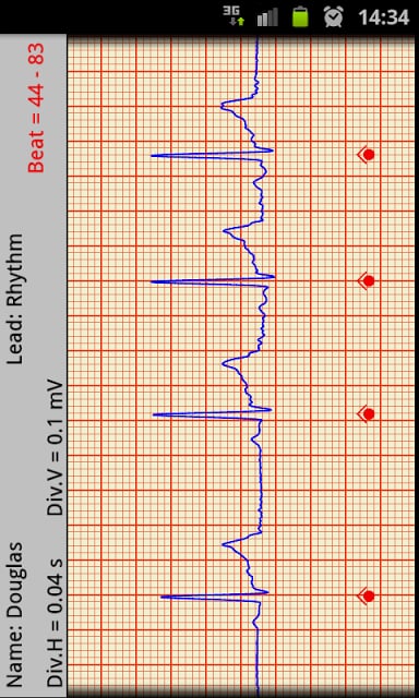 T-ECG User Telephonic ECG截图11