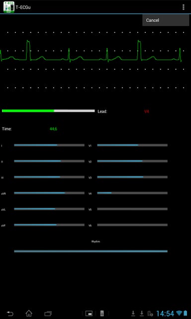 T-ECG User Telephonic ECG截图4