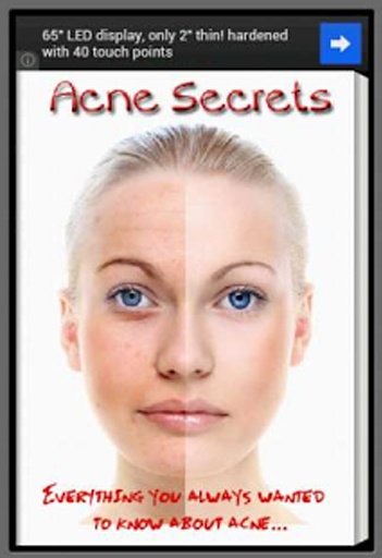 Acne Secrets截图6