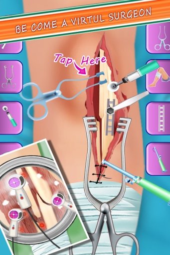 Knee Surgery Doctor截图2