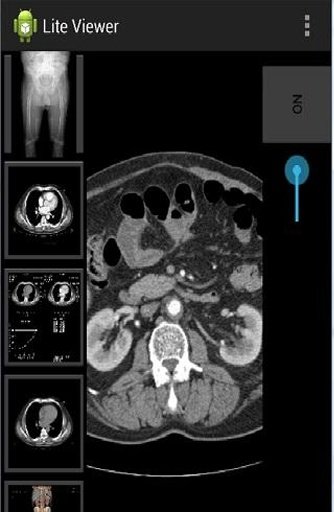 Dcm4chee Lite Viewer截图1