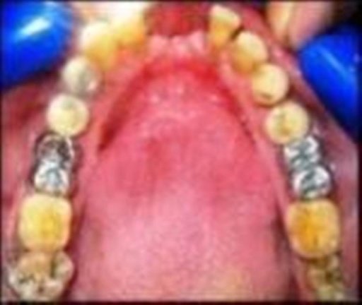 E-JOURNAL OF DENTISTRY截图6