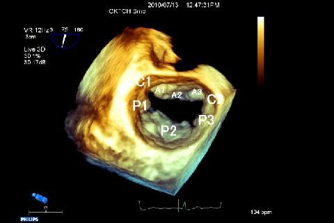 CARDIO3&reg; 3D ECHO - Lite截图2