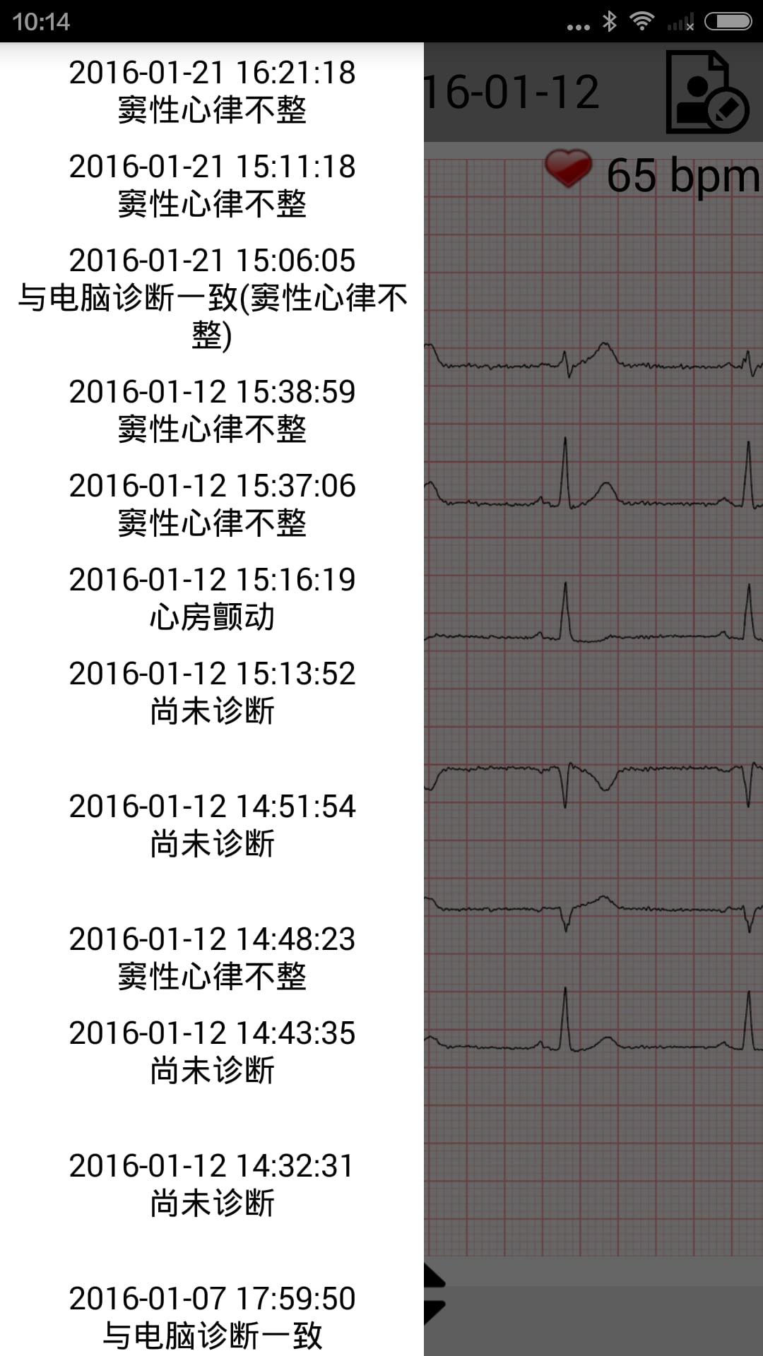 智能ECG截图3