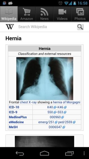 Hernia treatment!截图4