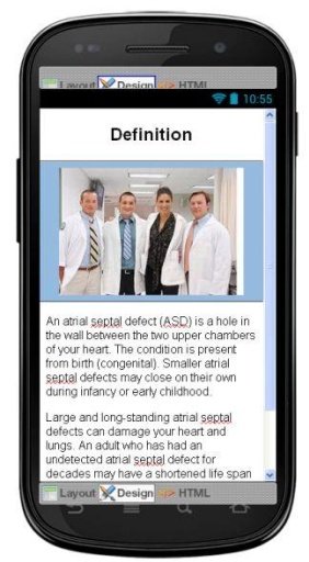 Atrial Septal Defect Disease截图4