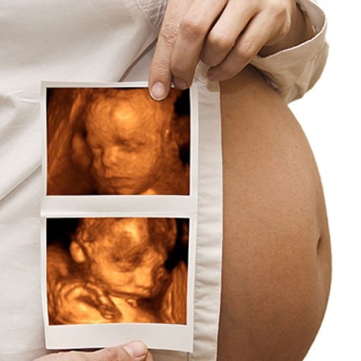 BABY SCANNER 4D ULTRASOUND截图6