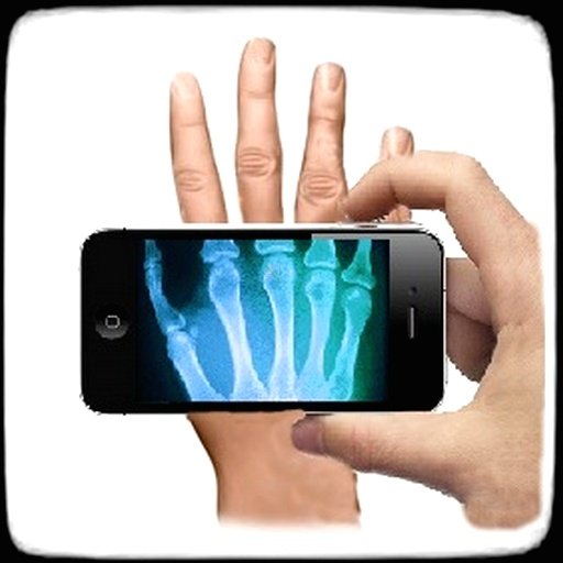 Xray Joke截图1