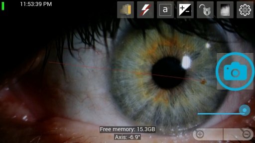 Slit Lamp Pro - Ophthalmic CAM截图2