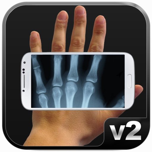 Xray 2 Prank截图2