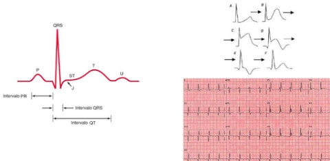 Electrocardiograma ECG Tipos截图2