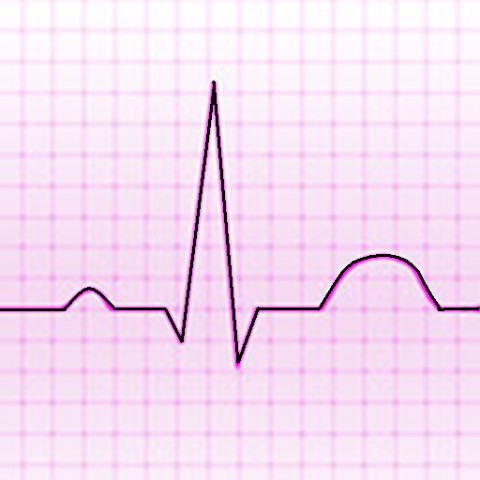 Electrocardiograma ECG Tipos截图1