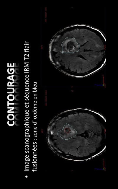 Siriade Digestif et Urologie截图4