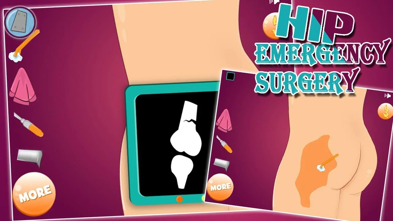 Virtual hip emergency surgery截图1