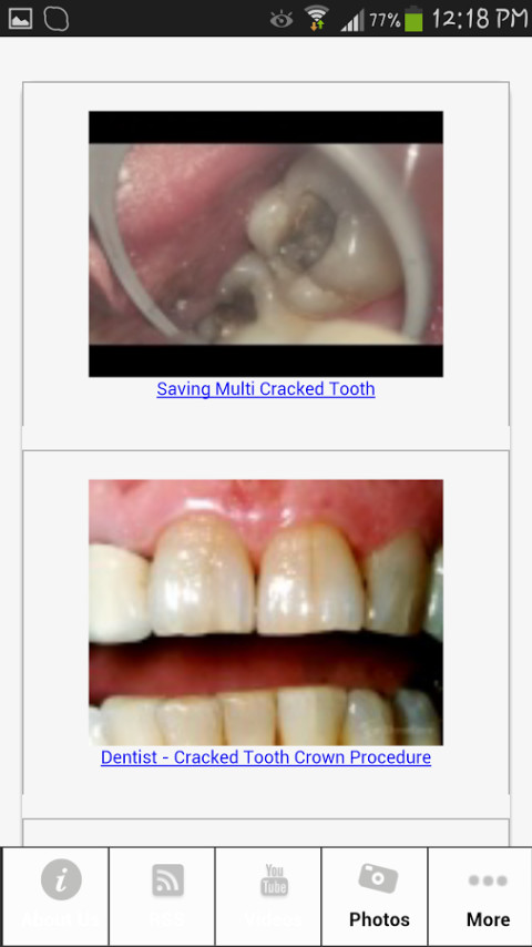 Fixing Cracked Tooth截图4