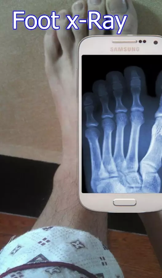 X-Ray Scanner for free截图10