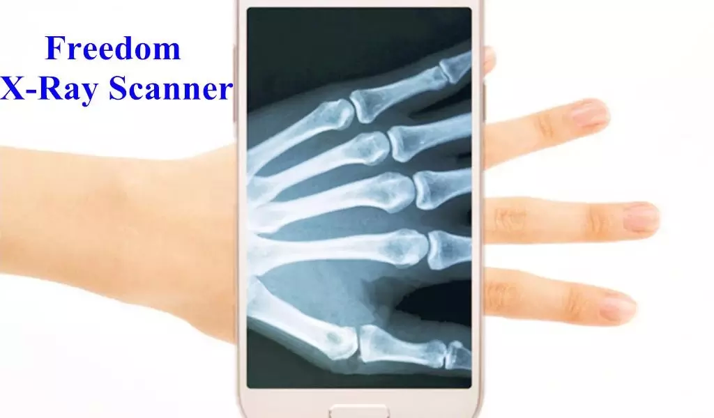 X-Ray Scanner for free截图7