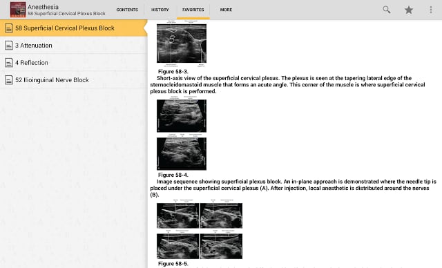 Atlas Ultrasound Anesthesia TR截图6