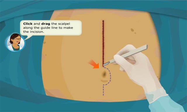 Virtual Doctor-Stomach Surgery截图1