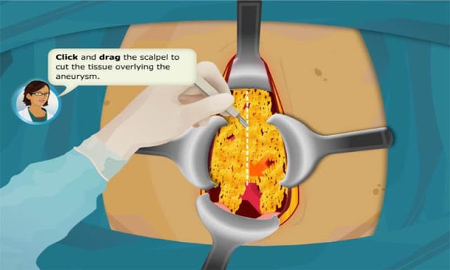 Virtual Doctor-Stomach Surgery截图3